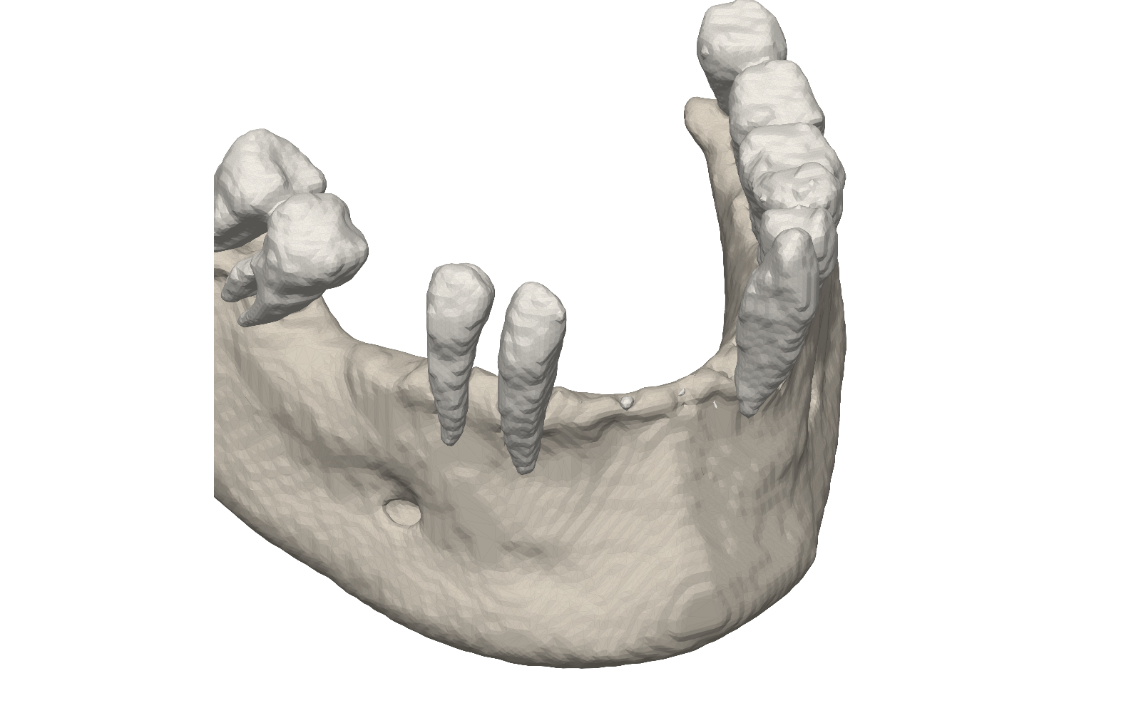 Segmented lower jaw with individual teeth and the traced inferior alveolar nerve canal.